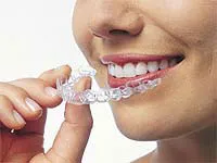 Photo of Invisalign clear aligners being taken out of patient's mouth