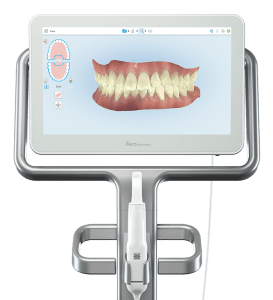 iTero Invisalign Scanner with an 3D image of teeth displayed on the screen